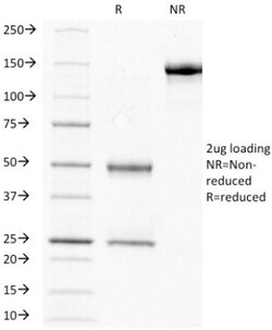 Mouse anti-Chorionic Gonadotropin beta Chain(HCG beta), Clone: HCGb/211,